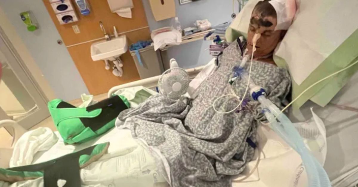 Woman loses both arms in vicious dog attack, lawsuit says
